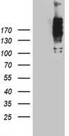 NUP214 / CAN Antibody - HEK293T cells were transfected with the pCMV6-ENTRY control. (Left lane) or pCMV6-ENTRY NUP214. (Right lane) cDNA for 48 hrs and lysed. Equivalent amounts of cell lysates. (5 ug per lane) were separated by SDS-PAGE and immunoblotted with anti-NUP214 rabbit polyclonal antibody.