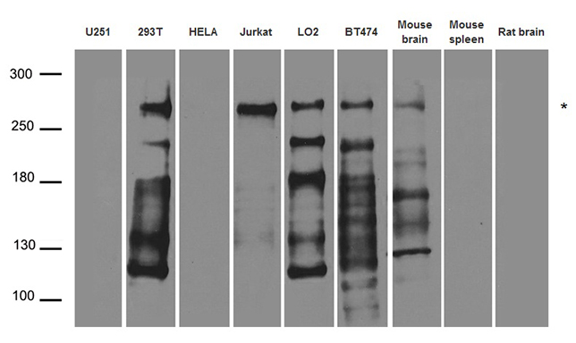 NUP214 / CAN Antibody - Western blot analysis of extracts. (35ug) from different cell lines and tissues by using anti-NUP214 rabbit polyclonal antibody.