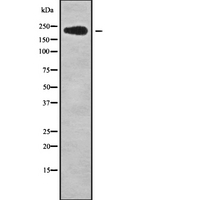 NUP214 / CAN Antibody - Western blot analysis NUP214 using LOVO cells whole cells lysates
