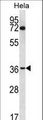 NUP35 / NUP53 Antibody - NUP35 Antibody western blot of HeLa cell line lysates (35 ug/lane). The NUP35 antibody detected the NUP35 protein (arrow).