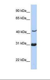 NUP35 / NUP53 Antibody - Jurkat cell lysate. Antibody concentration: 1.0 ug/ml. Gel concentration: 12%.  This image was taken for the unconjugated form of this product. Other forms have not been tested.