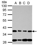 NUP35 / NUP53 Antibody - Sample (30 ug of whole cell lysate) A: 293T B: A431 C: HeLa D: HepG2 10% SDS PAGE NUP35 / NUP53 antibody diluted at 1:1000