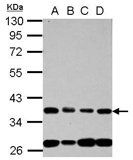 NUP35 / NUP53 Antibody - Sample (30 ug of whole cell lysate) A: 293T B: A431 C: HeLa D: HepG2 10% SDS PAGE NUP35 / NUP53 antibody diluted at 1:1000