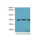 NUP35 / NUP53 Antibody - Western blot. All lanes: NUP35 antibody at 12 ug/ml. Lane 1: Jurkat whole cell lysate. Lane 2: A431 whole cell lysate. Lane 3: HepG-2 whole cell lysate. Secondary Goat polyclonal to Rabbit IgG at 1:10000 dilution. Predicted band size: 35 kDa. Observed band size: 35 kDa.