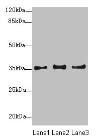 NUP35 / NUP53 Antibody - Western blot All lanes: NUP35 antibody at 12µg/ml Lane 1: Jurkat whole cell lysate Lane 2: A431 whole cell lysate Lane 3: HepG2 whole cell lysate Secondary Goat polyclonal to rabbit IgG at 1/10000 dilution Predicted band size: 35, 34, 22 kDa Observed band size: 35 kDa