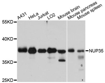 NUP35 / NUP53 Antibody - Western blot analysis of extracts of various cell lines, using NUP35 antibody at 1:3000 dilution. The secondary antibody used was an HRP Goat Anti-Rabbit IgG (H+L) at 1:10000 dilution. Lysates were loaded 25ug per lane and 3% nonfat dry milk in TBST was used for blocking. An ECL Kit was used for detection and the exposure time was 5s.