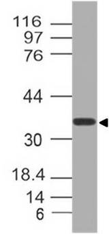 NUP35 / NUP53 Antibody - Fig-1: Western blot analysis of NUP35. Anti-NUP35 antibody was used at 1 µg/ml on 293 lysate.