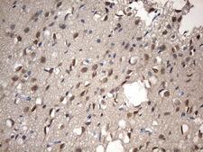 NUP43 Antibody - Immunohistochemical staining of paraffin-embedded Human adult brain tissue using anti-NUP43 mouse monoclonal antibody. (Heat-induced epitope retrieval by 1 mM EDTA in 10mM Tris, pH8.5, 120C for 3min. (1:150)