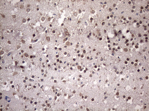 NUP43 Antibody - Immunohistochemical staining of paraffin-embedded Human embryonic brain cortex tissue using anti-NUP43 mouse monoclonal antibody. (Heat-induced epitope retrieval by 1 mM EDTA in 10mM Tris, pH8.5, 120C for 3min. (1:150)