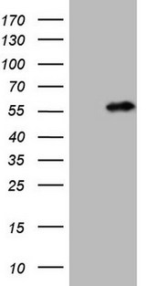 NUP43 Antibody - HEK293T cells were transfected with the pCMV6-ENTRY control (Left lane) or pCMV6-ENTRY NUP43 (Right lane) cDNA for 48 hrs and lysed. Equivalent amounts of cell lysates (5 ug per lane) were separated by SDS-PAGE and immunoblotted with anti-NUP43 (1:2000).