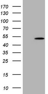 NUP43 Antibody - HEK293T cells were transfected with the pCMV6-ENTRY control (Left lane) or pCMV6-ENTRY NUP43 (Right lane) cDNA for 48 hrs and lysed. Equivalent amounts of cell lysates (5 ug per lane) were separated by SDS-PAGE and immunoblotted with anti-NUP43.