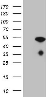 NUP43 Antibody - HEK293T cells were transfected with the pCMV6-ENTRY control (Left lane) or pCMV6-ENTRY NUP43 (Right lane) cDNA for 48 hrs and lysed. Equivalent amounts of cell lysates (5 ug per lane) were separated by SDS-PAGE and immunoblotted with anti-NUP43.