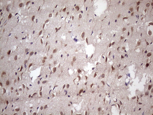 NUP43 Antibody - Immunohistochemical staining of paraffin-embedded Human adult brain tissue using anti-NUP43 mouse monoclonal antibody. (Heat-induced epitope retrieval by 1 mM EDTA in 10mM Tris, pH8.5, 120C for 3min. (1:150)