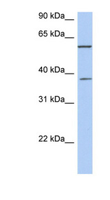 NUP43 Antibody - NUP43 antibody Western blot of Fetal Thymus lysate. This image was taken for the unconjugated form of this product. Other forms have not been tested.