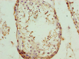NUP43 Antibody - Immunohistochemistry of paraffin-embedded human testis tissue using NUP43 Antibody at dilution of 1:100