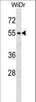 NUP50 Antibody - NUP50 Antibody western blot of WiDr cell line lysates (35 ug/lane). The NUP50 antibody detected the NUP50 protein (arrow).