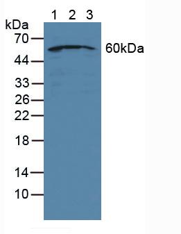 NUP50 Antibody - Western Blot; Sample: Lane1: Human Jurkat Cells; Lane2: Human Hela Cells; Lane3: Human HepG2 Cells.