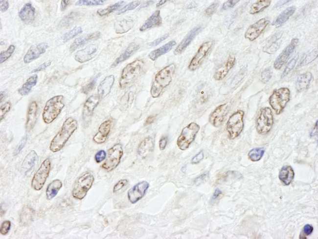 NUP50 Antibody - Detection of Human NUP50 by Immunohistochemistry. Sample: FFPE section of human prostate-nodular hypertrophy. Antibody: Affinity purified rabbit anti-NUP50 used at a dilution of 1:500.