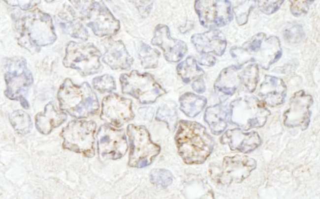 NUP50 Antibody - Detection of Mouse NUP50 by Immunohistochemistry. Sample: FFPE section of mouse teratoma. Antibody: Affinity purified rabbit anti-NUP50 used at a dilution of 1:500.