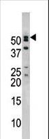NUP50 Antibody - Western blot of anti-NUP50 antibody in mouse brain tissue lysate. NUP50(arrow) was detected using the purified antibody.