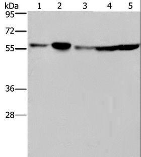 NUP50 Antibody - Western blot analysis of HeLa, 293T, A549, HT-29 and K562 cell, using NUP50 Polyclonal Antibody at dilution of 1:200.