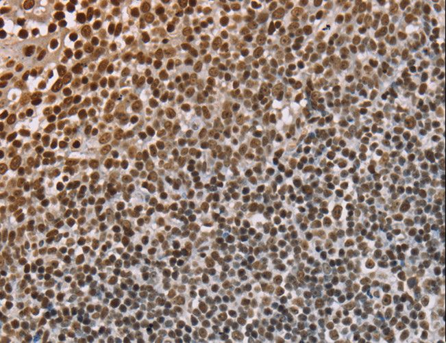 NUP50 Antibody - Immunohistochemistry of paraffin-embedded Human tonsil using NUP50 Polyclonal Antibody at dilution of 1:30.