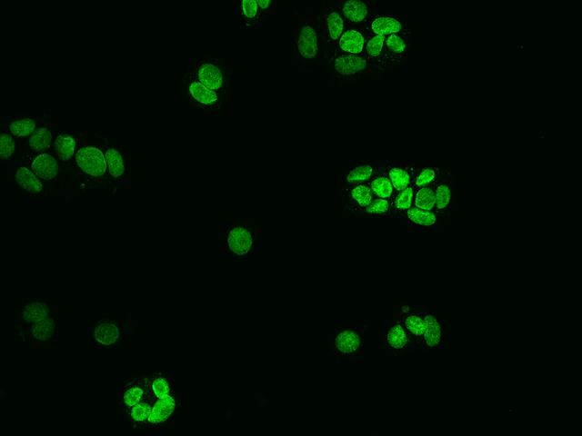NUP50 Antibody - Immunofluorescence staining of NUP50 in MCF7 cells. Cells were fixed with 4% PFA, permeabilzed with 0.1% Triton X-100 in PBS, blocked with 10% serum, and incubated with rabbit anti-Human NUP50 polyclonal antibody (dilution ratio 1:200) at 4°C overnight. Then cells were stained with the Alexa Fluor 488-conjugated Goat Anti-rabbit IgG secondary antibody (green). Positive staining was localized to Nucleus.