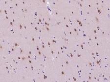 NUP50 Antibody - Immunochemical staining of human NUP50 in human brain with rabbit polyclonal antibody at 1:100 dilution, formalin-fixed paraffin embedded sections.