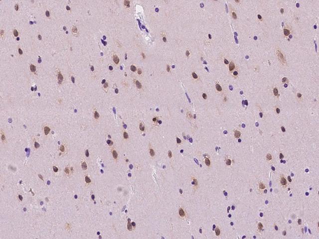 NUP50 Antibody - Immunochemical staining of human NUP50 in human brain with rabbit polyclonal antibody at 1:100 dilution, formalin-fixed paraffin embedded sections.