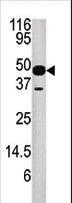 NUP54 Antibody - Western blot of anti-NUP54 antibody in mouse heart tissue lysate.NUP54(arrow) was detected using the purified antibody.