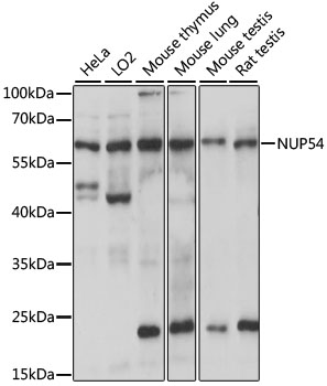NUP54 Antibody - Western blot analysis of extracts of various cell lines, using NUP54 antibody at 1:1000 dilution. The secondary antibody used was an HRP Goat Anti-Rabbit IgG (H+L) at 1:10000 dilution. Lysates were loaded 25ug per lane and 3% nonfat dry milk in TBST was used for blocking. An ECL Kit was used for detection and the exposure time was 10s.