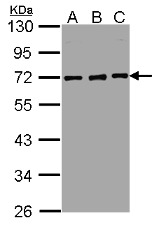 NUP62 Antibody - Sample (30 ug whole cell lysate). A: Hep G2 , B: MOLT4 , C: Raji . 10% SDS PAGE. NUP62 antibody diluted at 1:5000