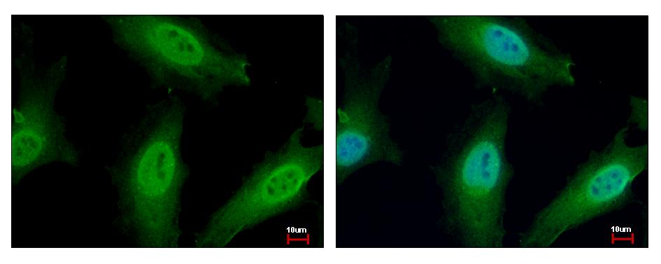 NUP62 Antibody - Nucleoporin p62 antibody detects NUP62 protein at Cytoplasm and Nucleus by immunofluorescent analysis. HeLa cells were fixed in 4% paraformaldehyde at RT for 15 min. NUP62 protein stained by Nucleoporin p62 antibody diluted at 1:500. 