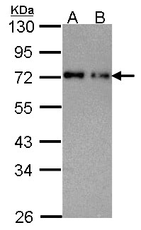NUP62 Antibody - Sample (30 ug of whole cell lysate). A: A431 , B: H1299. 10% SDS PAGE. nucleoporin p62 antibody. NUP62 antibody diluted at 1:1000.