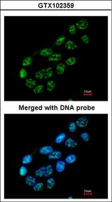 NUP62 Antibody - Immunofluorescence of paraformaldehyde-fixed A431 using nucleoporin p62 antibody at 1:200 dilution.