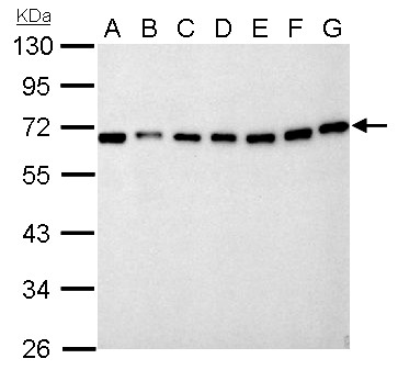 NUP62 Antibody - Nucleoporin p62 antibody detects NUP62 protein by Western blot analysis. A. 30 ug Neuro2A whole lysate/extract. B. 30 ug GL261 whole cell lysate/extract. C. 30 ug C8D30 whole cell lysate/extract. D. 30 ug NIH-3T3 whole cell lysate/extract. E. 30 ug BCL-1 whole cell lysate/extract. F. 30 ug Raw264.7 whole cell lysate/extract. G. 30 ug C2C12 whole cell lysate/extract. 10 % SDS-PAGE. Nucleoporin p62 antibody dilution:1:1000
