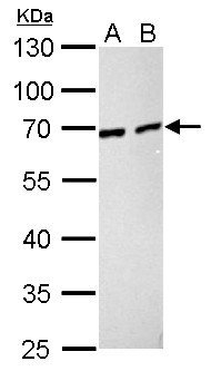 NUP62 Antibody - Nucleoporin p62 antibody detects NUP62 protein by Western blot analysis. A. 30 ug PC-12 whole cell lysate/extract. B. 30 ug Rat2 whole cell lysate/extract. 10 % SDS-PAGE. Nucleoporin p62 antibody dilution:1:1000