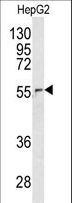 NUP62 Antibody - Western blot of NUP62 antibody (C-term E507) in HepG2 cell line lysates (35 ug/lane). NUP62 (arrow) was detected using the purified antibody.