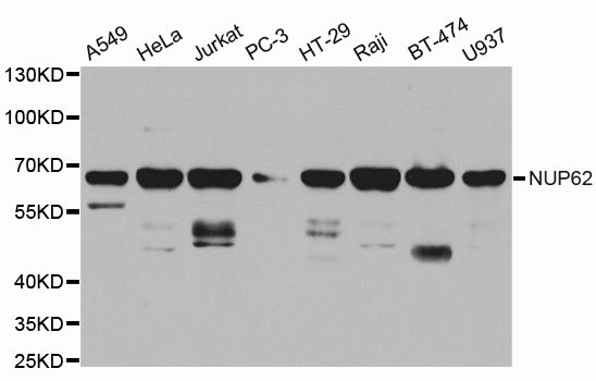 NUP62 Antibody - Western blot analysis of extracts of various cell lines.