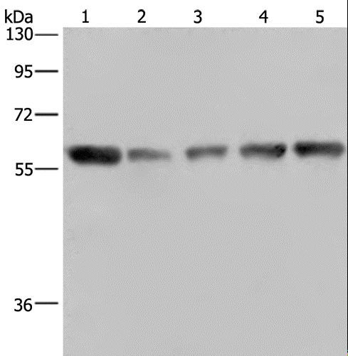NUP62 Antibody - Western blot analysis of HeLa cell and human brain malignant glioma tissue, NIH/3T3, PC3 and A549 cell, using NUP62 Polyclonal Antibody at dilution of 1:300.