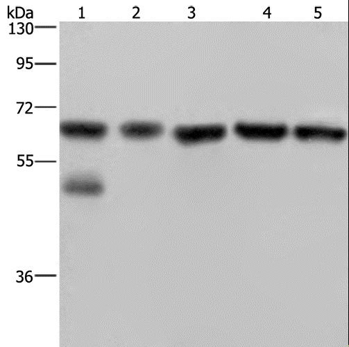 NUP62 Antibody - Western blot analysis of Jurkat cell and human brain malignant glioma tissue, PC3, K562 and A549 cell, using NUP62 Polyclonal Antibody at dilution of 1:300.