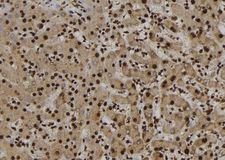 NUP62 Antibody - 1:100 staining human liver tissue by IHC-P. The sample was formaldehyde fixed and a heat mediated antigen retrieval step in citrate buffer was performed. The sample was then blocked and incubated with the antibody for 1.5 hours at 22°C. An HRP conjugated goat anti-rabbit antibody was used as the secondary.