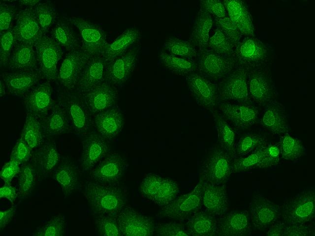 NUP62 Antibody - Immunofluorescence staining of NUP62 in U2OS cells. Cells were fixed with 4% PFA, permeabilzed with 0.1% Triton X-100 in PBS, blocked with 10% serum, and incubated with rabbit anti-Human NUP62 polyclonal antibody (dilution ratio 1:200) at 4°C overnight. Then cells were stained with the Alexa Fluor 488-conjugated Goat Anti-rabbit IgG secondary antibody (green). Positive staining was localized to nuclear membrane.