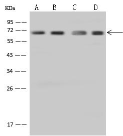 NUP62 Antibody - Anti-NUP62 rabbit polyclonal antibody at 1:500 dilution. Lane A: A431 Whole Cell Lysate. Lane B: HepG2 Whole Cell Lysate. Lane C: Jurkat Whole Cell Lysate. Lane D: MOLT-4 Whole Cell Lysate. Lysates/proteins at 30 ug per lane. Secondary: Goat Anti-Rabbit IgG (H+L)/HRP at 1/10000 dilution. Developed using the ECL technique. Performed under reducing conditions. Predicted band size: 53 kDa. Observed band size: 70 kDa.