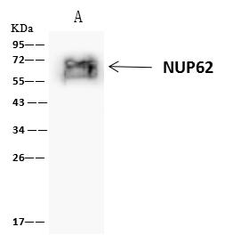 NUP62 Antibody - NUP62 was immunoprecipitated using: Lane A: 0.5 mg Jurkat Whole Cell Lysate. 4 uL anti-NUP62 rabbit polyclonal antibody and 60 ug of Immunomagnetic beads Protein A/G. Primary antibody: Anti-NUP62 rabbit polyclonal antibody, at 1:100 dilution. Secondary antibody: Clean-Blot IP Detection Reagent (HRP) at 1:1000 dilution. Developed using the ECL technique. Performed under reducing conditions. Predicted band size: 53 kDa. Observed band size: 70 kDa.