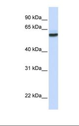 NUP62 Antibody - Fetal brain lysate. Antibody concentration: 1.0 ug/ml. Gel concentration: 12%.  This image was taken for the unconjugated form of this product. Other forms have not been tested.