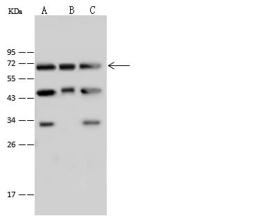 NUP62 Antibody - Anti-NUP62 rabbit polyclonal antibody at 1:500 dilution. Lane A: H1299 Whole Cell Lysate. Lane B: HepG2 Whole Cell Lysate. Lane C: Jurkat Whole Cell Lysate. Lysates/proteins at 30 ug per lane. Secondary: Goat Anti-Rabbit IgG (H+L)/HRP at 1/10000 dilution. Developed using the ECL technique. Performed under reducing conditions. Predicted band size: 53 kDa.