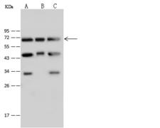 NUP62 Antibody - Anti-NUP62 rabbit polyclonal antibody at 1:500 dilution. Lane A: H1299 Whole Cell Lysate. Lane B: HepG2 Whole Cell Lysate. Lane C: Jurkat Whole Cell Lysate. Lysates/proteins at 30 ug per lane. Secondary: Goat Anti-Rabbit IgG (H+L)/HRP at 1/10000 dilution. Developed using the ECL technique. Performed under reducing conditions. Predicted band size: 53 kDa.