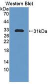 NUP85 / Pericentrin 1 Antibody - Western blot of NUP85 / Pericentrin 1 antibody.