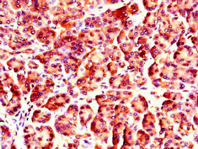NUP85 / Pericentrin 1 Antibody - Immunohistochemistry of paraffin-embedded human pancreatic tissue using NUP85 Antibody at dilution of 1:100